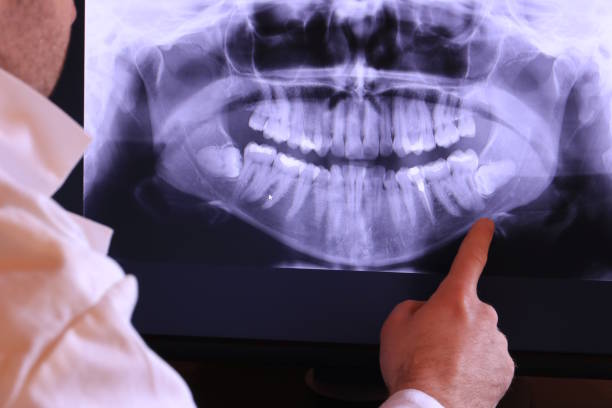 Best Broken Tooth Emergency  in Mccrory, AR