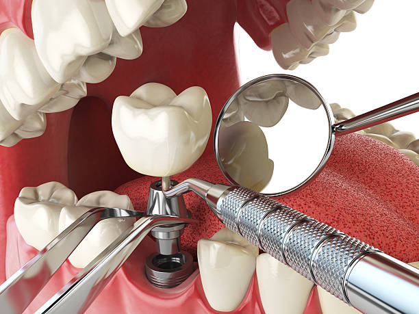 Best Broken Tooth Emergency  in Mccrory, AR
