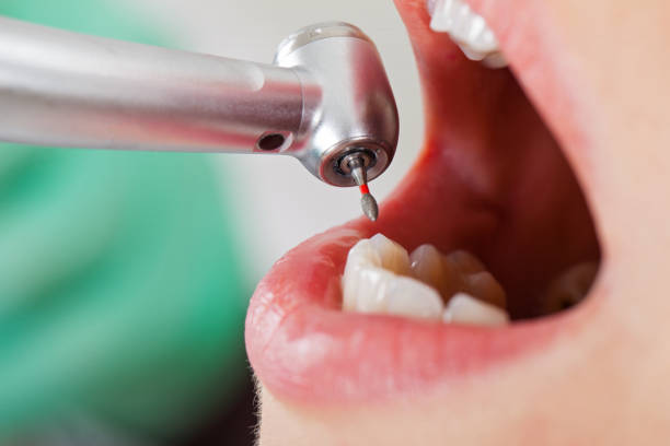 Best Tooth Infection Emergency Dentist  in Mccrory, AR